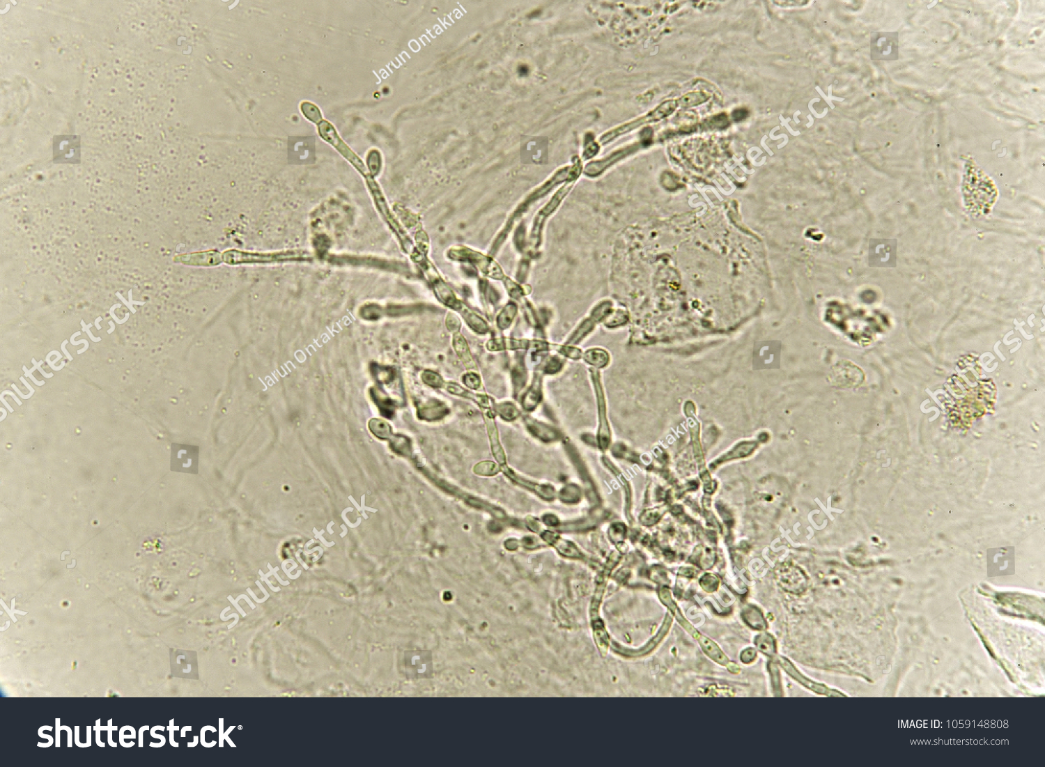 Pseudohyphae Budding Yeast Cells Patient Urine Stock Photo 1059148808 ...