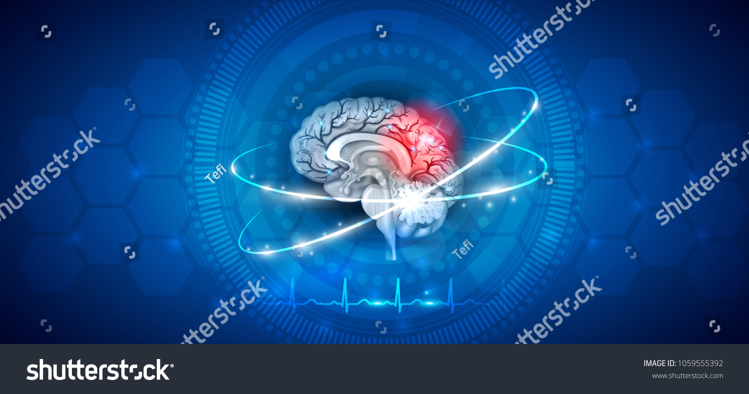 Brain Damage Treatment On Abstract Blue Stock Vector (Royalty Free ...