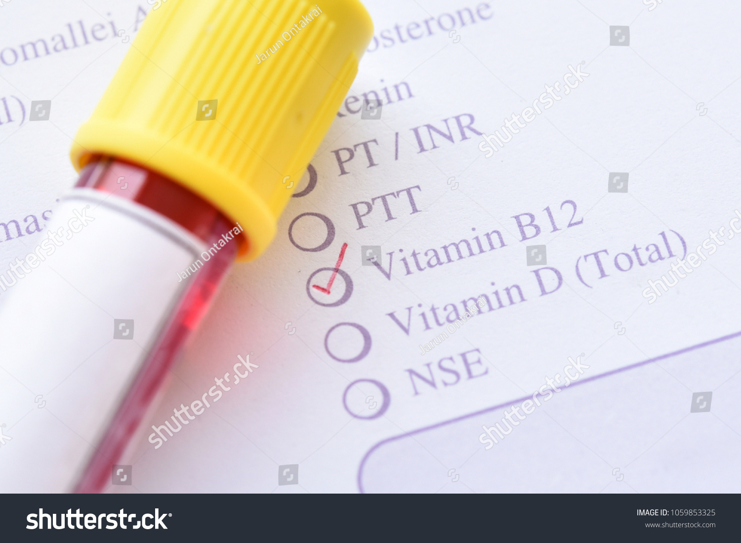 Test Tube Blood Sample Vitamin B12 Stock Photo 1059853325 | Shutterstock