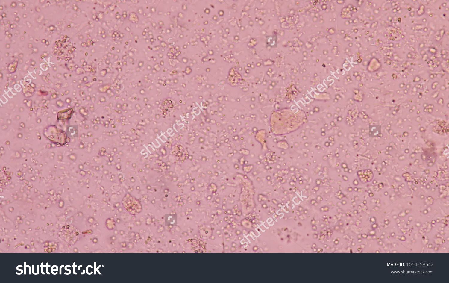 Budding Yeast Stool Exam Find Microscope Stock Photo 1064258642 