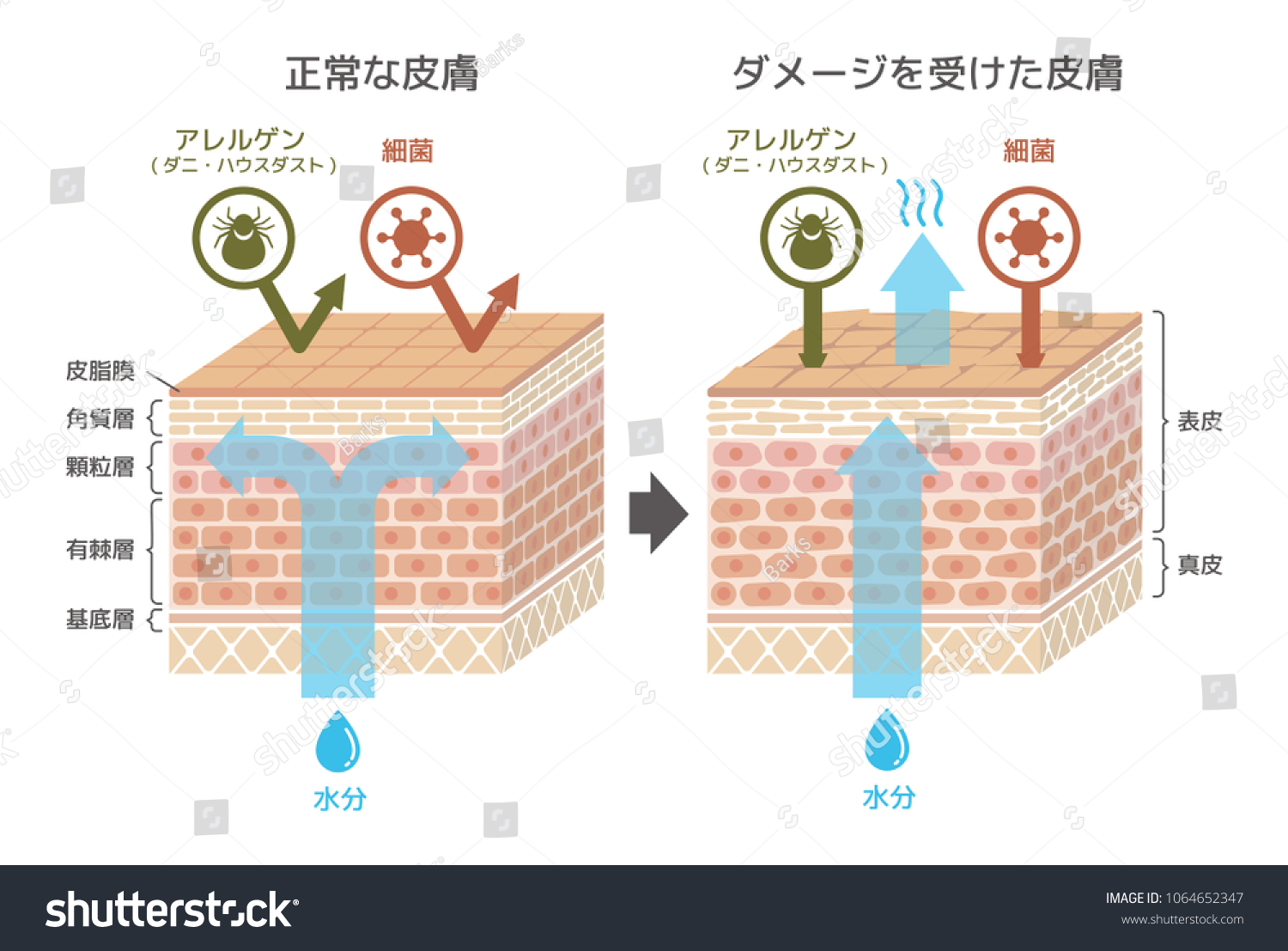 Sectional View Skincomparison Illustration Protection Effect Stock ...