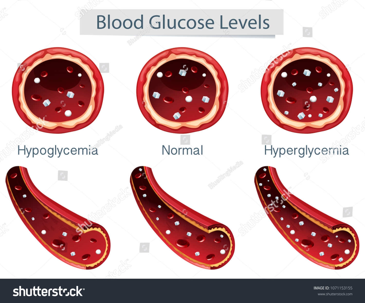 3 Different Blood Glucose Levels Illustration Stock Vector (Royalty ...