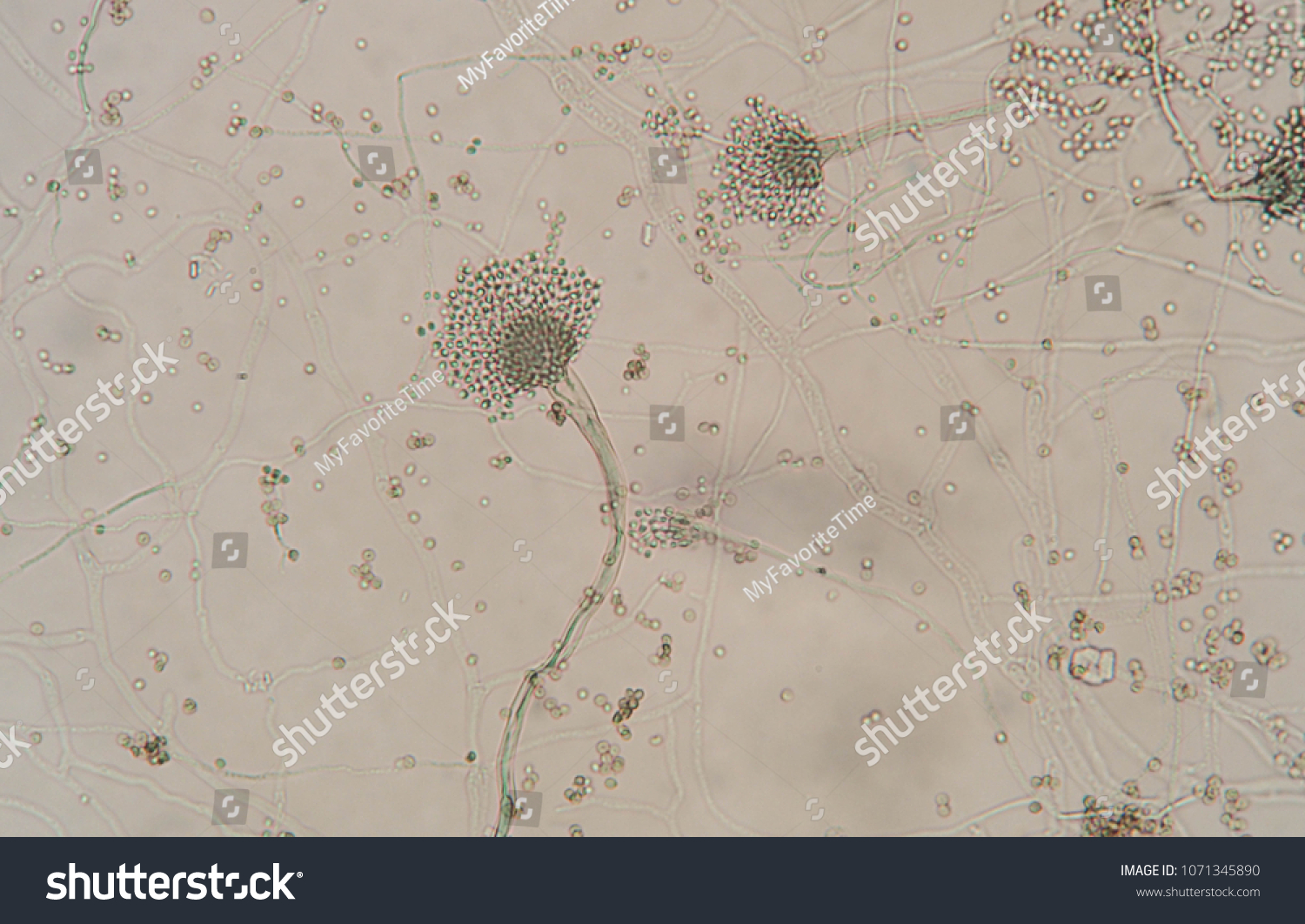 Microscopic Morphology Aspergillus Spp Using Lactophenol Stock Photo ...