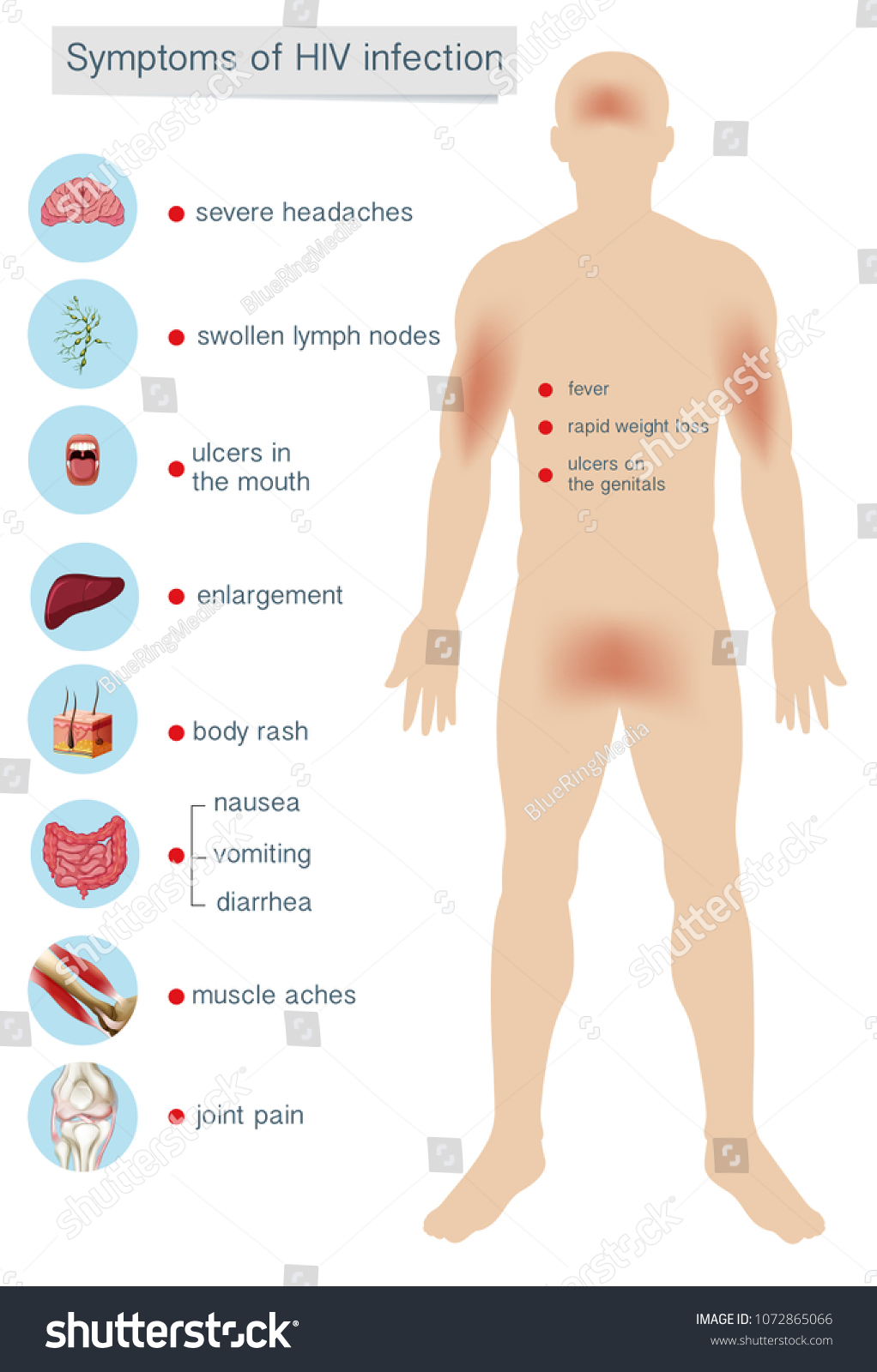 Human Anatomy Symptoms Hiv Infection Illustration Stock Vector (Royalty ...