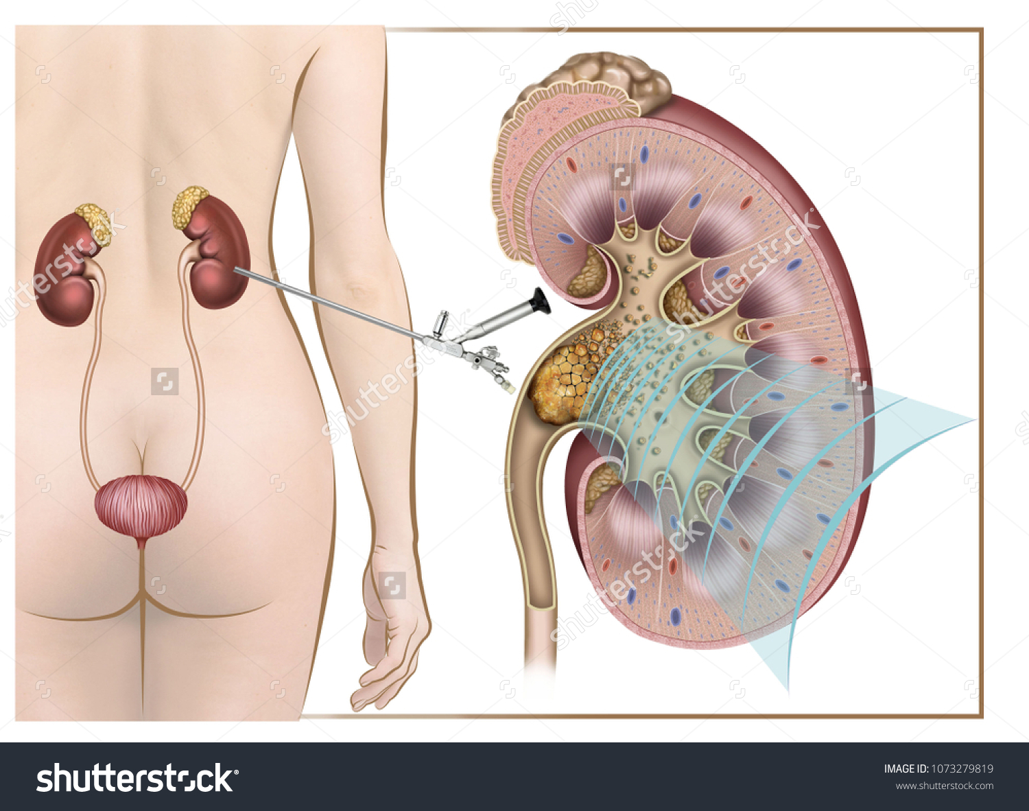 human kidney dissection