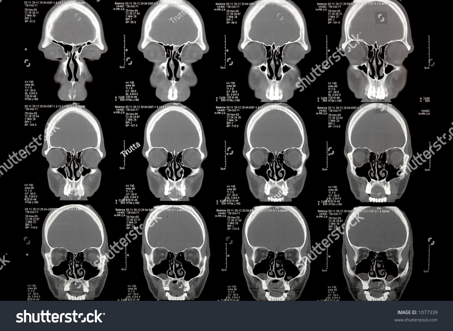 Modern Radiology Brain Ct Stock Photo 1077339 | Shutterstock