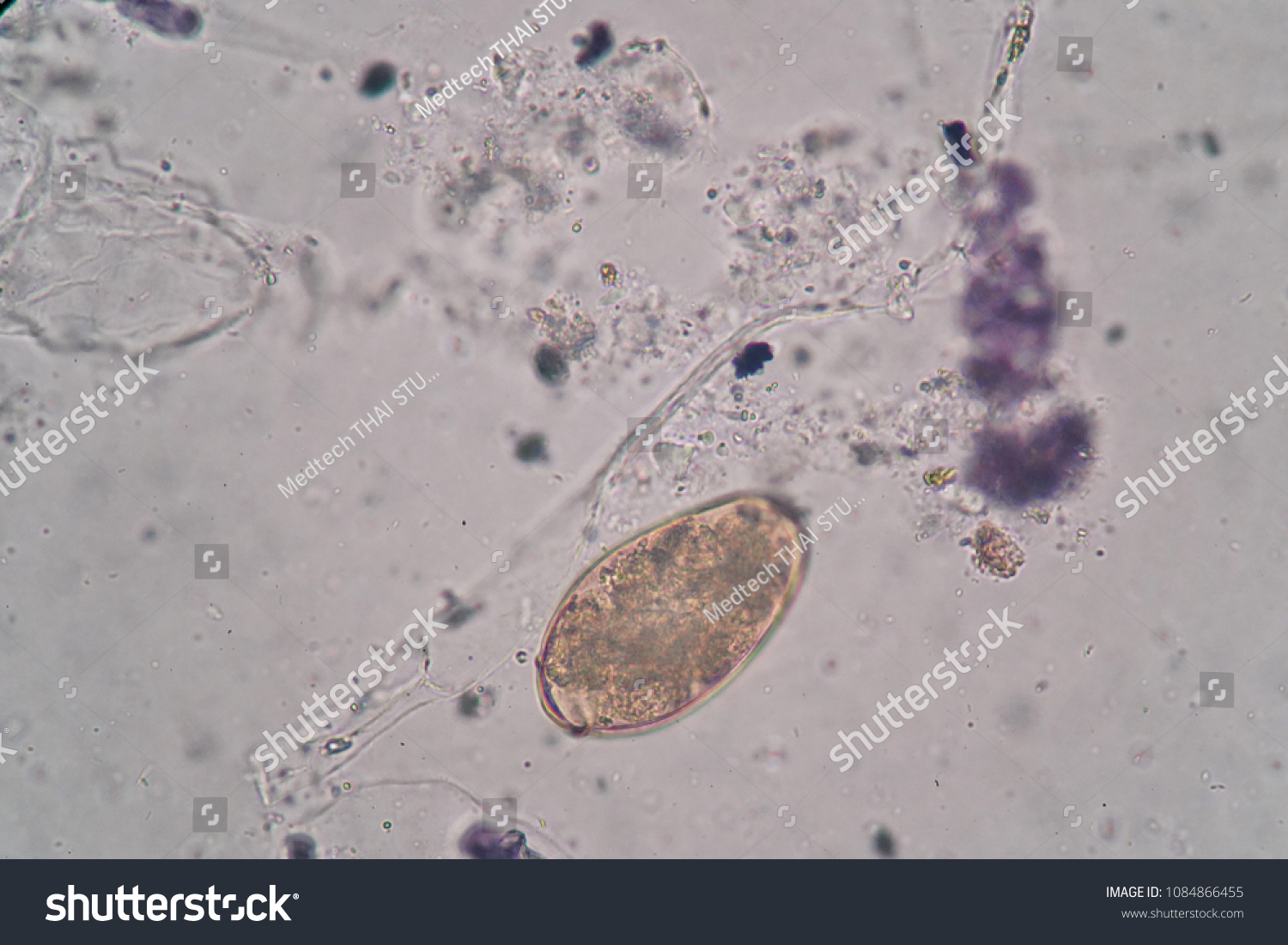 paragonimus westermani egg size