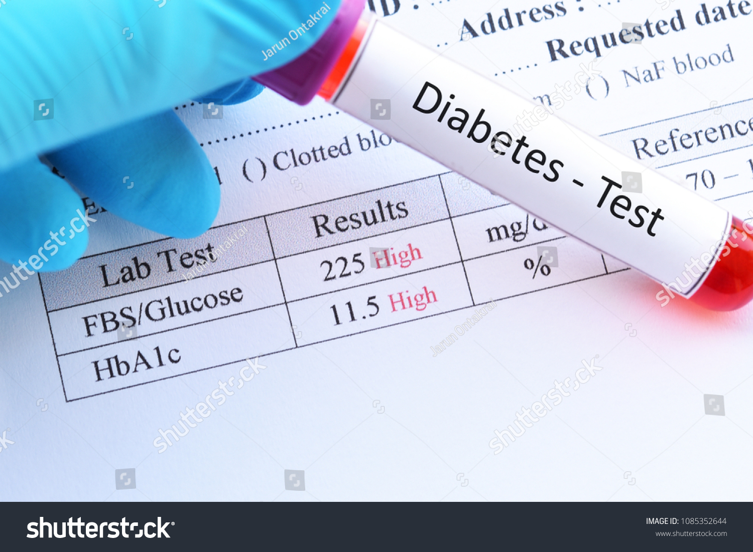 Type 2 Diabetes Blood Sugar Goals