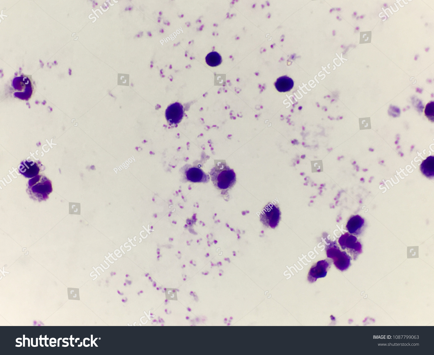 plasmodium falciparum under microscope