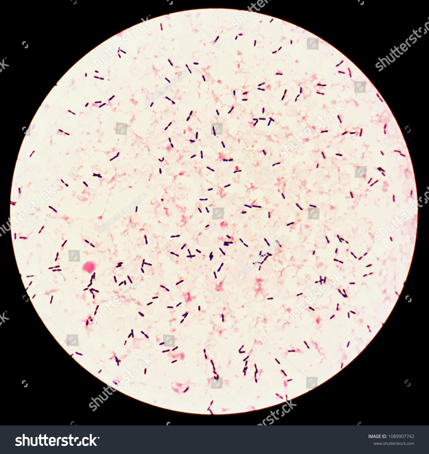 Smear Human Blood Culture Grams Stained Stock Photo 1089907742 ...