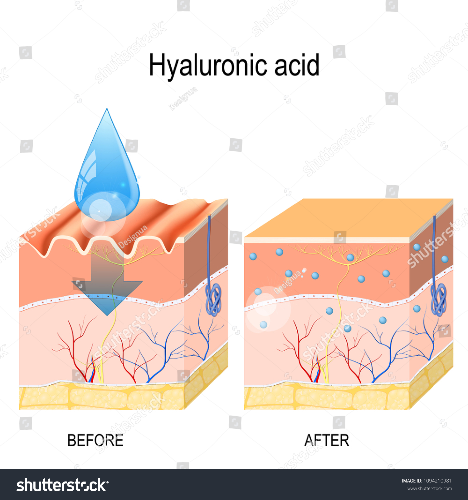 Hyaluronic Acid Skincare Products Skin Rejuvenation Stock Vector ...