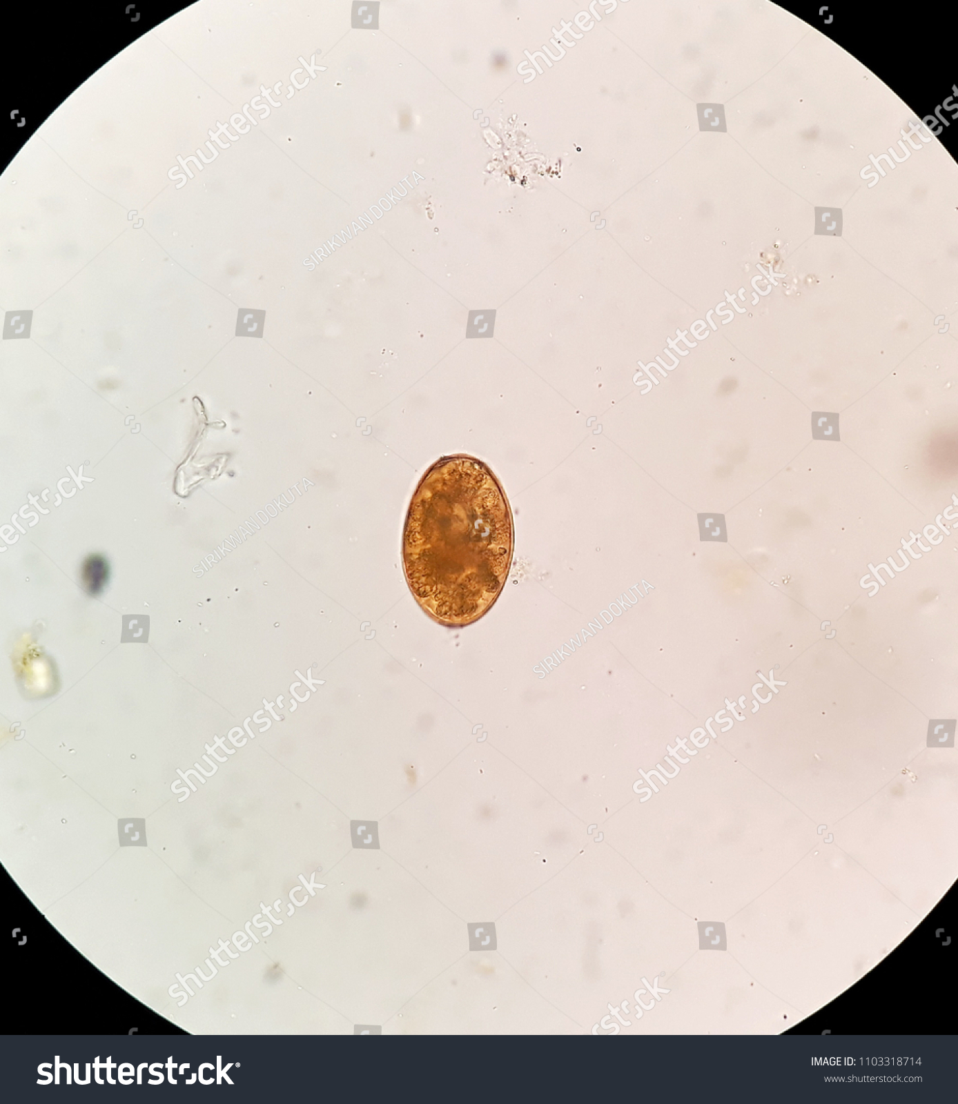 Diphyllobothrium Latum Egg Stool Examination Under Stock Photo ...