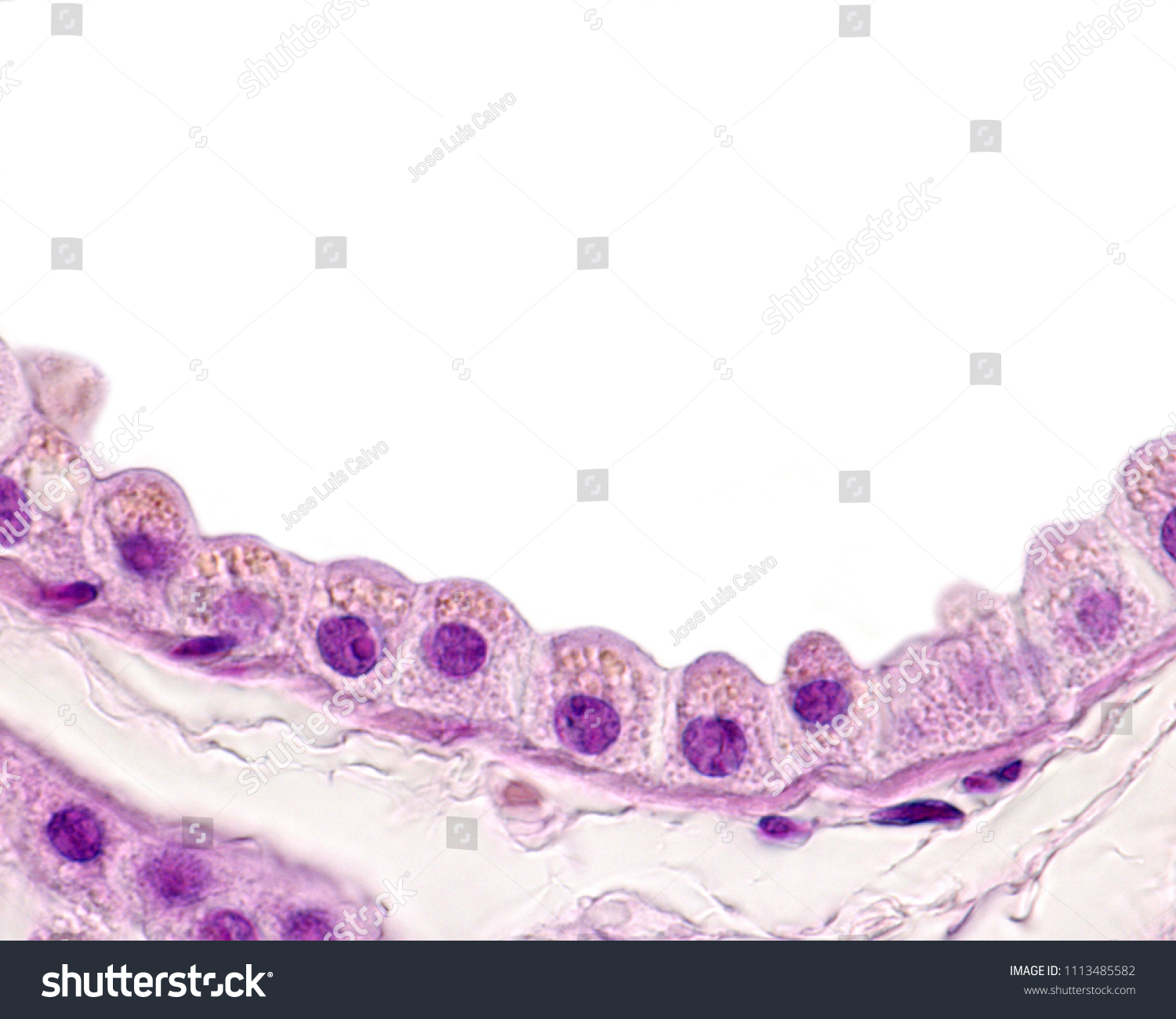 Columnar Simple Epithelium Apocrine Sweat Gland Stock Photo 1113485582 ...