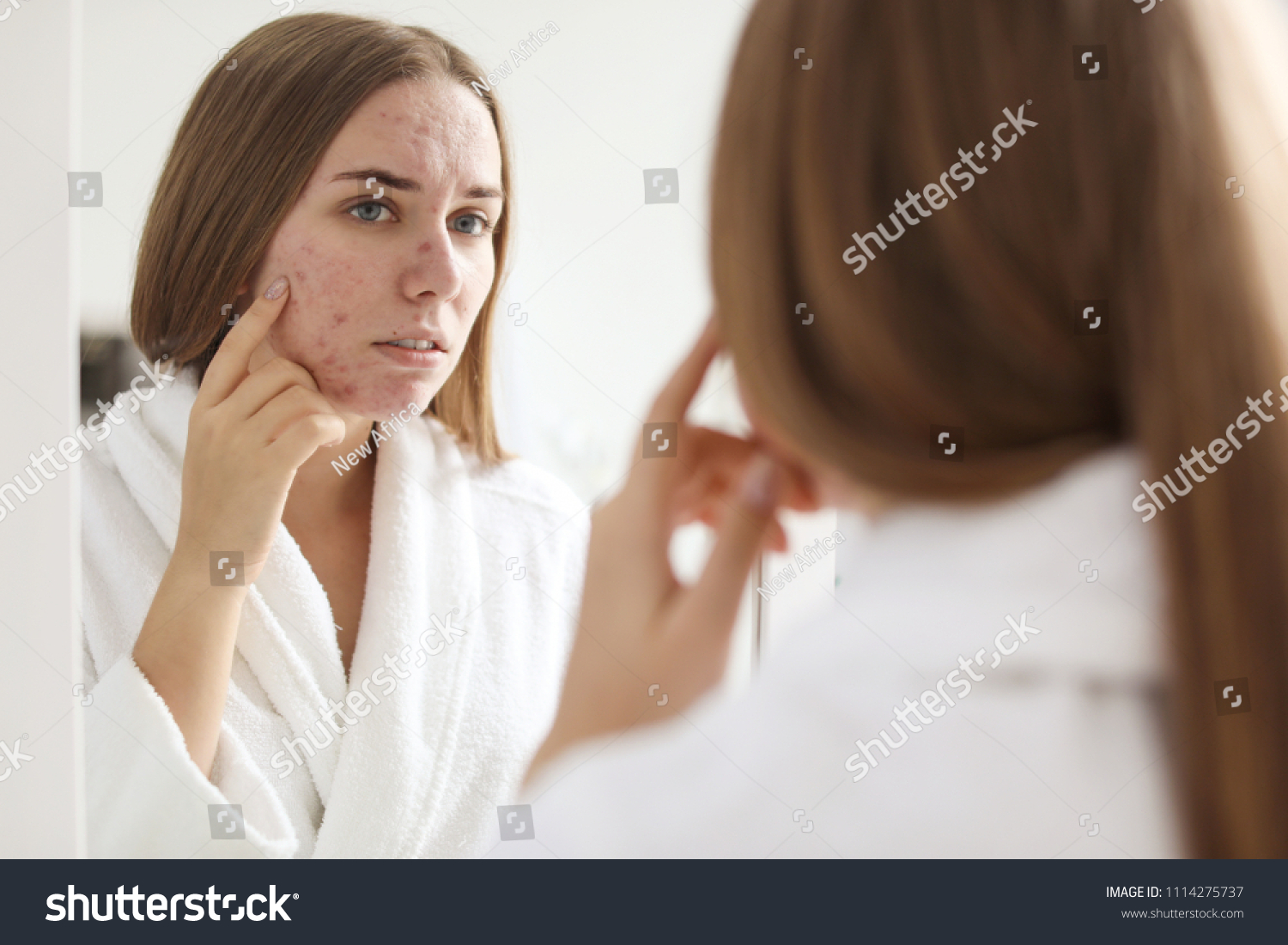 Young Woman Acne Problem Near Mirror Foto Stock 1114275737 Shutterstock 6565