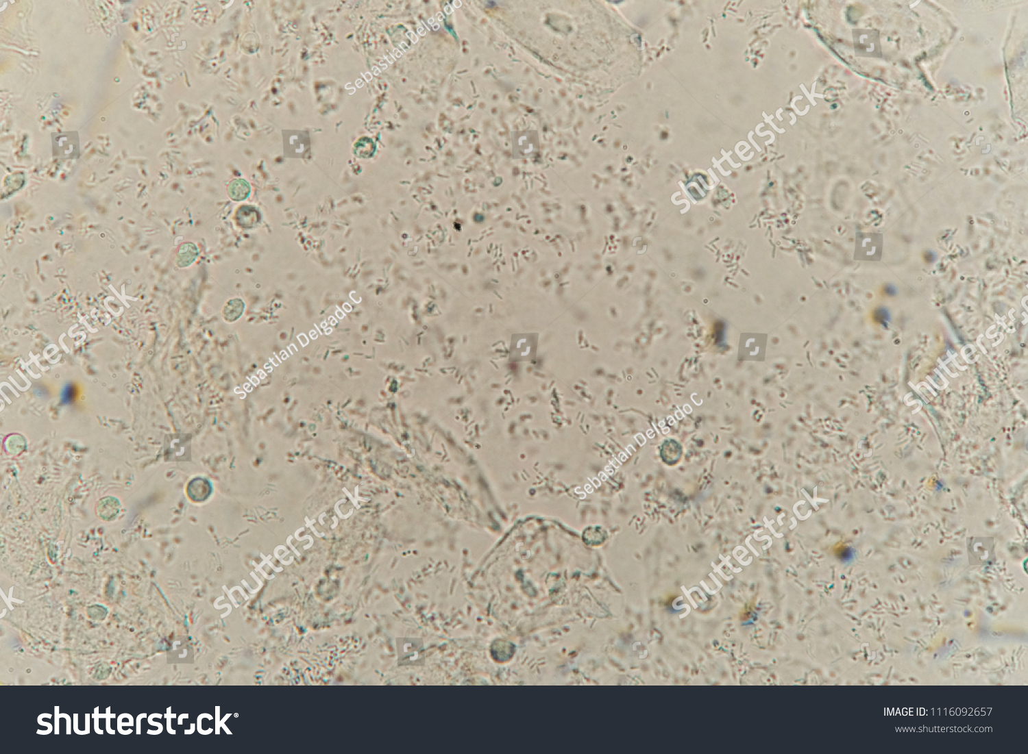 Urine Sample Under Microscope Stock Photo 1116092657 | Shutterstock