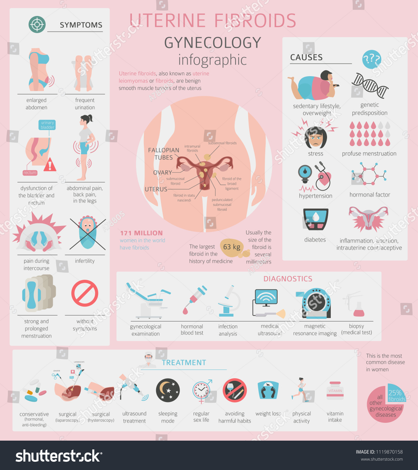 Uterine Fibroids Ginecological Medical Desease Women Stock Vector ...