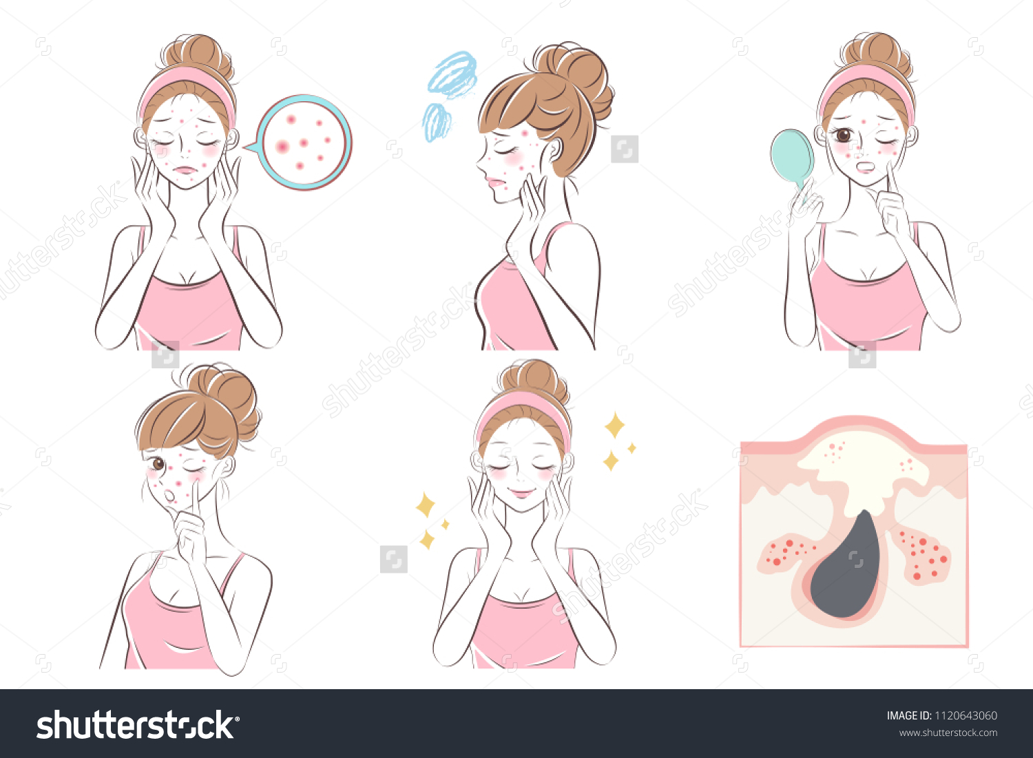 Cartoon Beauty Woman Acne Problem On Stock Vector (Royalty Free ...