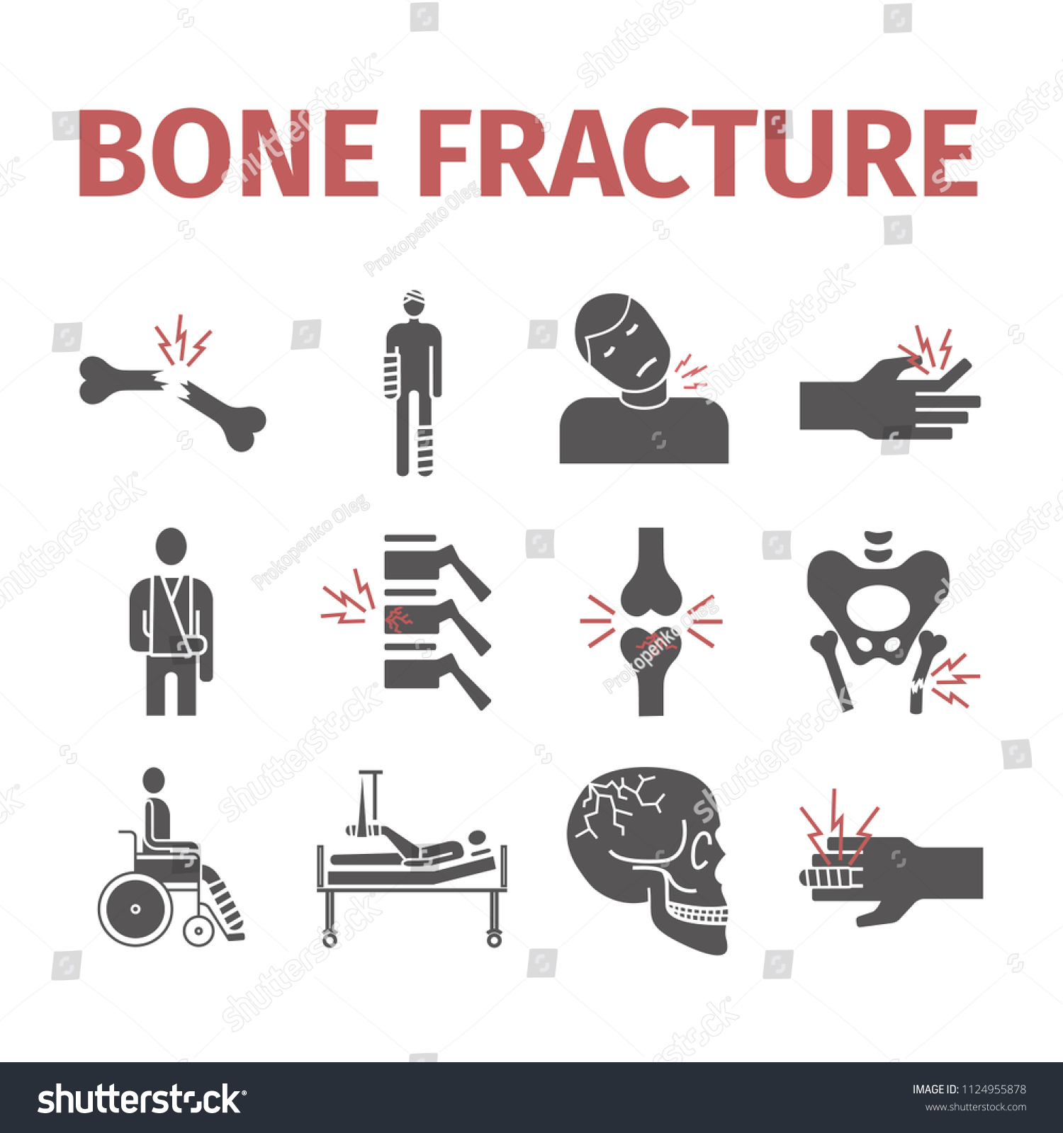 Bone Fractures Icons Treatment Infographic Vector Stock Vector (Royalty ...