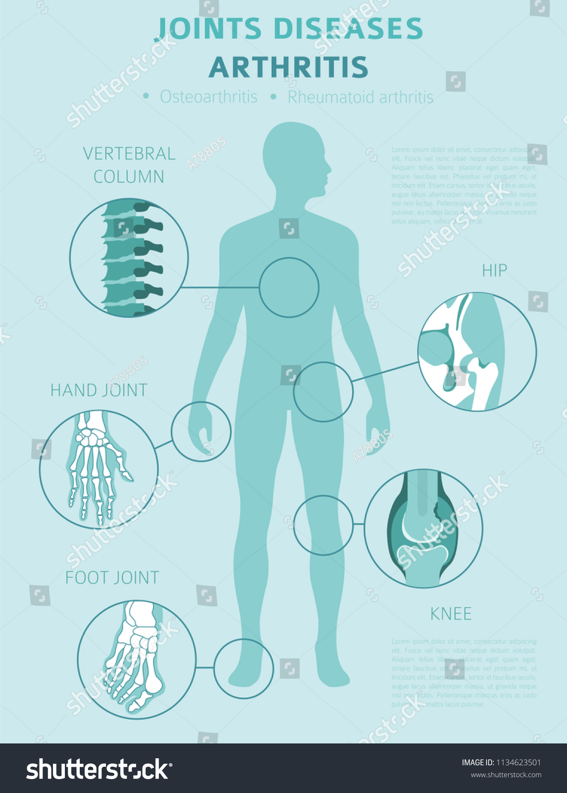 Joints Diseases Arthritis Symptoms Treatment Icon Stock Vector (Royalty ...