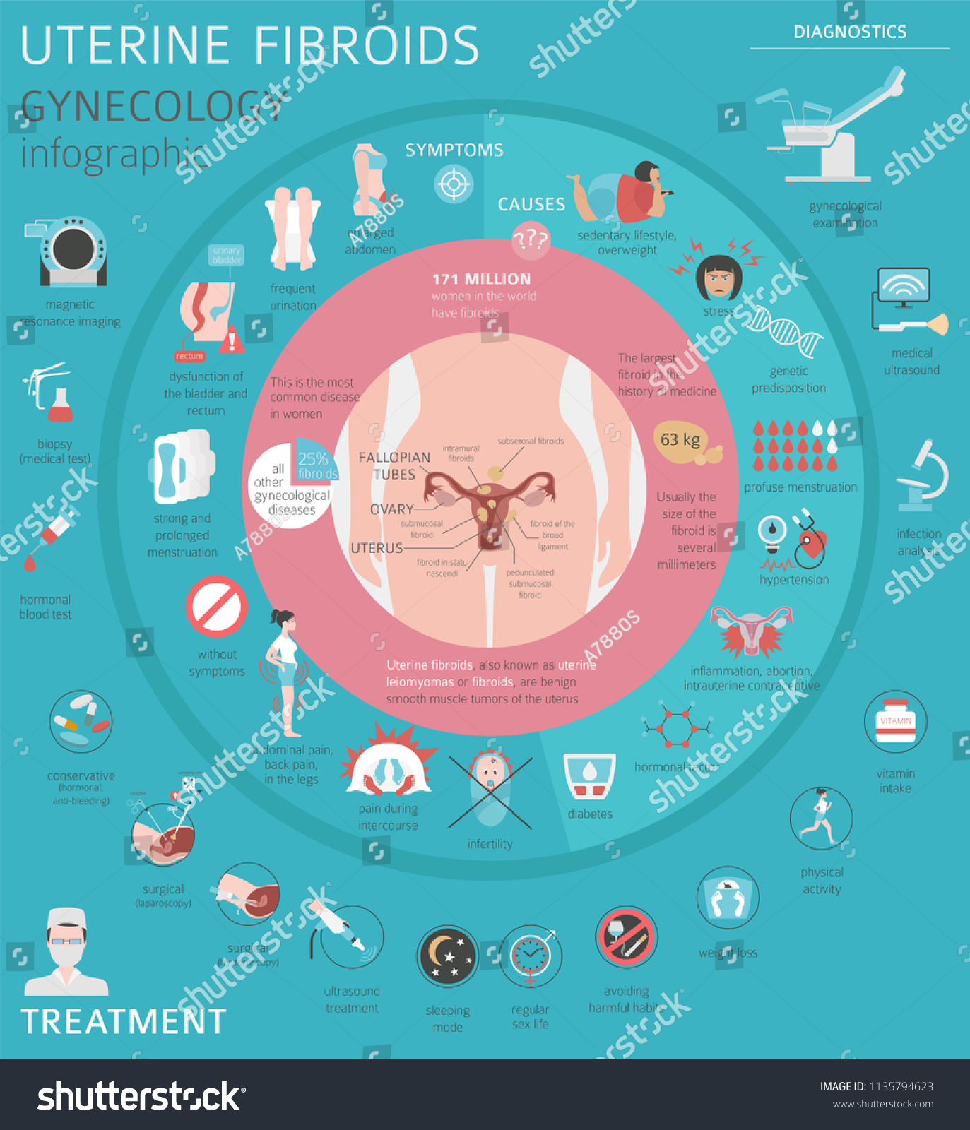 Uterine Fibroids Ginecological Medical Desease Women Stock Vector