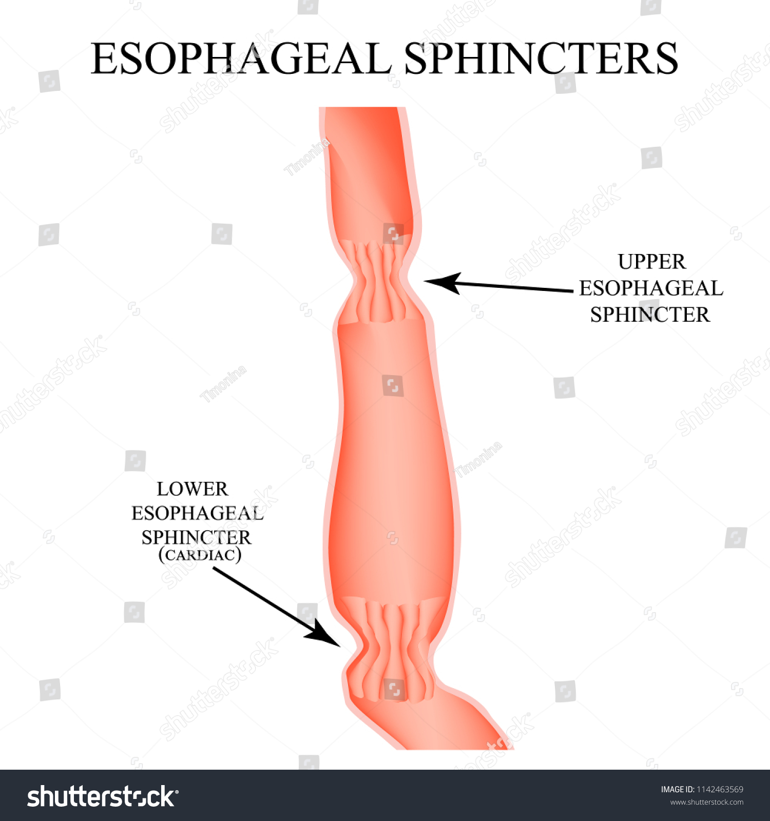 Upper Sphincter Esophagus Lower Cardiac Esophageal Stock Illustration 1142463569 Shutterstock 6106