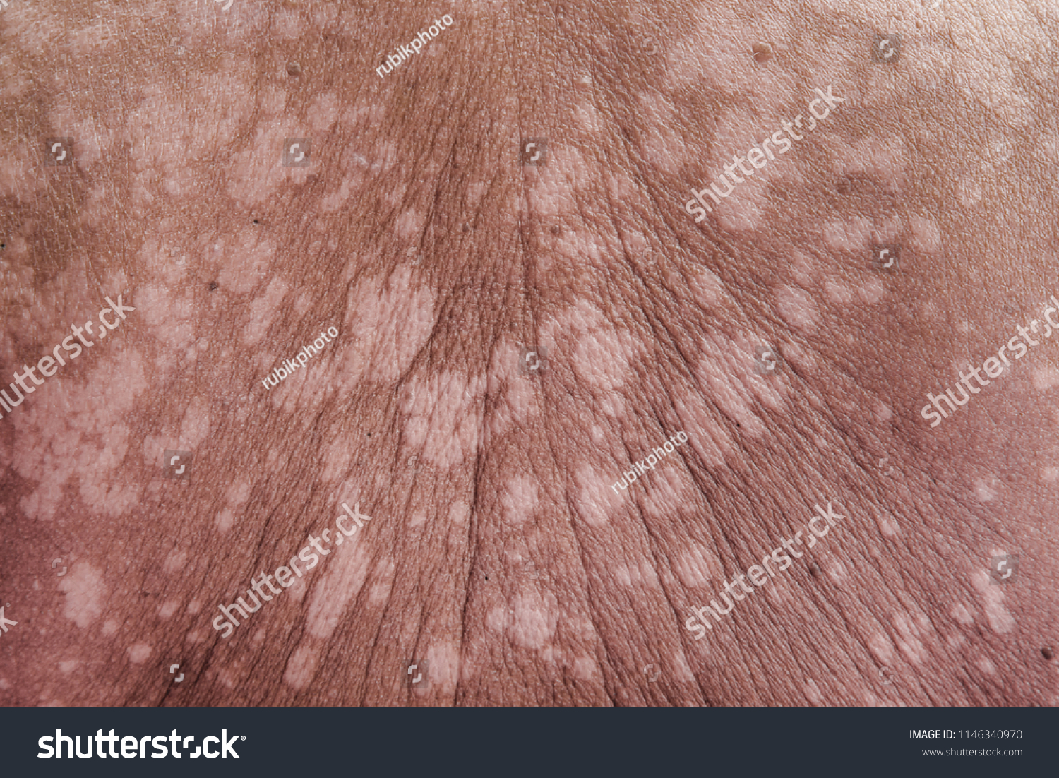 white human skin texture