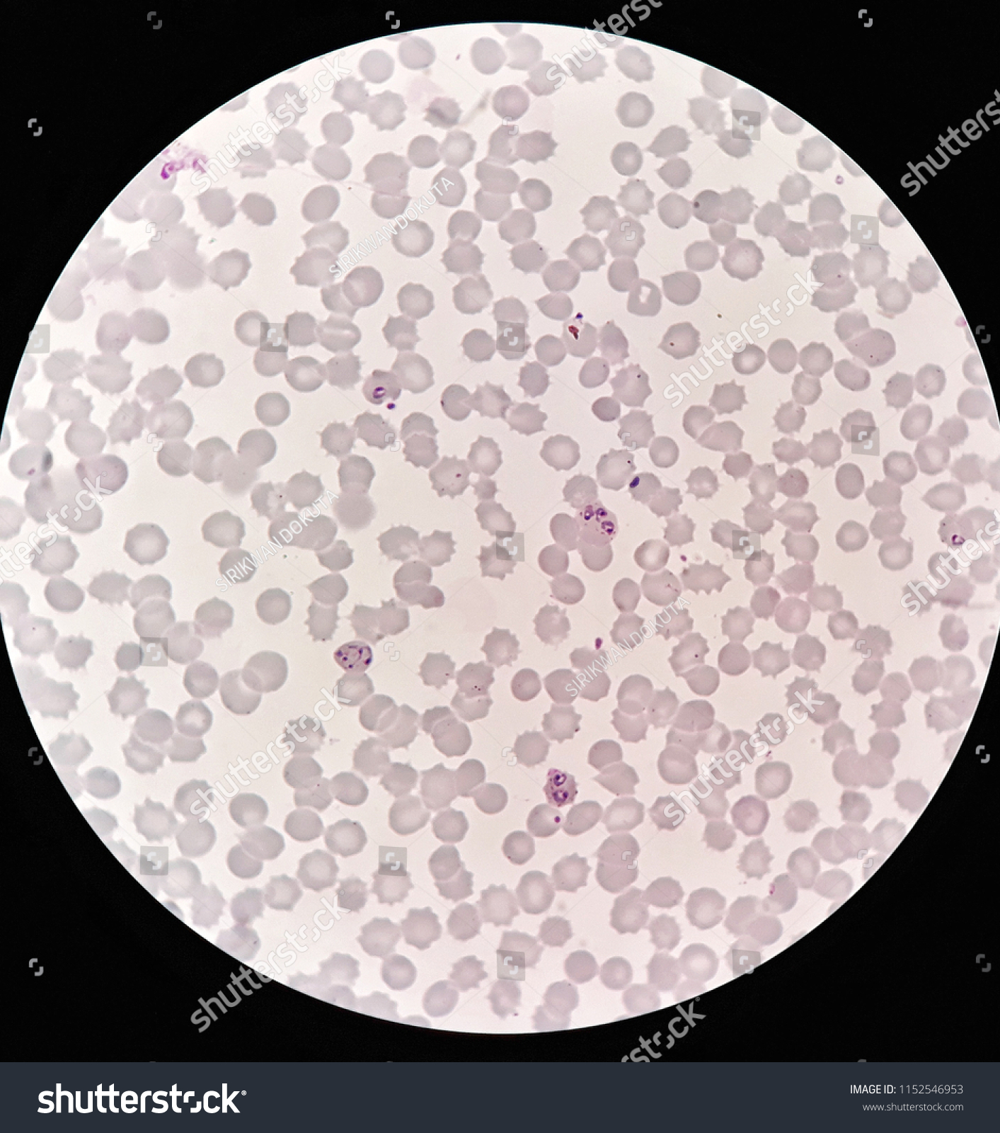 plasmodium falciparum under microscope