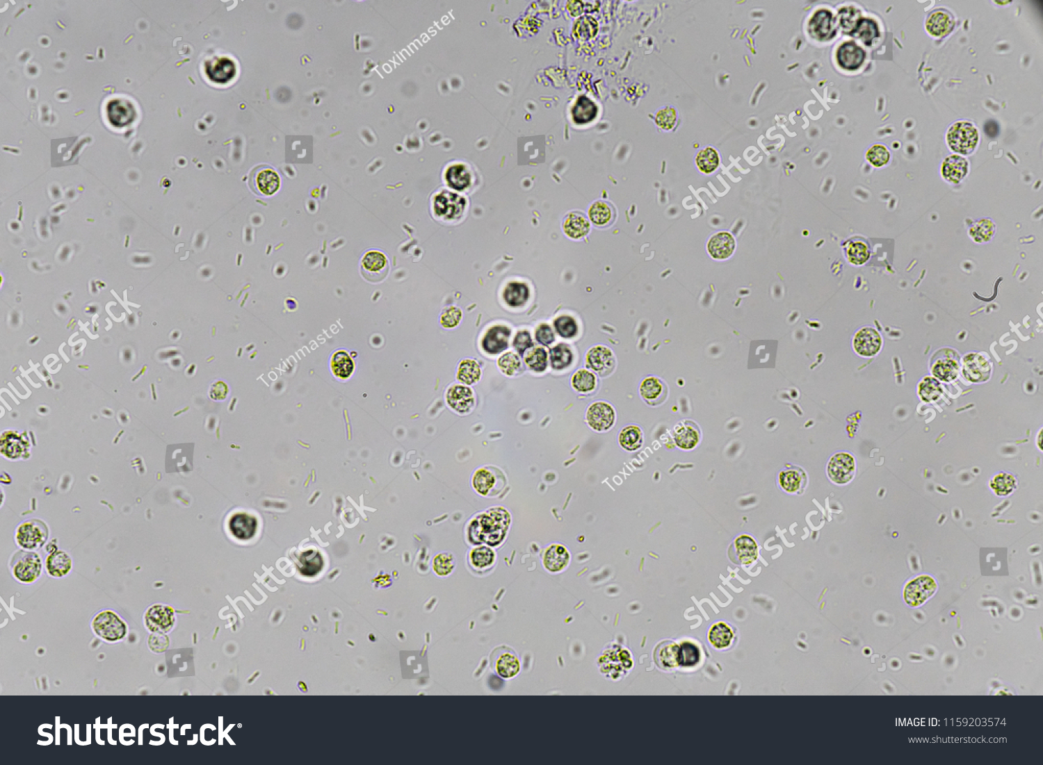 White Blood Cells Bacteria Urine Stock Photo 1159203574 