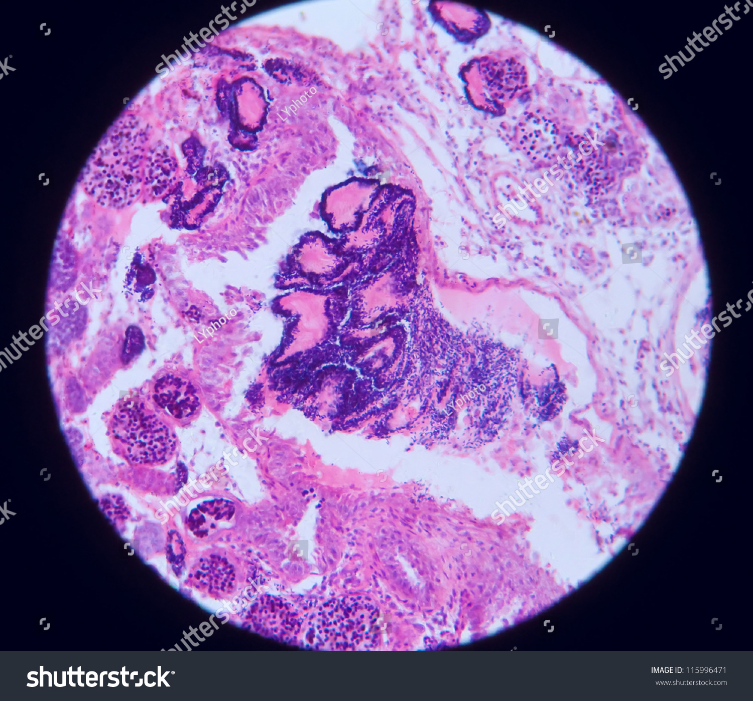 Rare Material Microscope Section Gonad Swordtail Stock Photo 115996471 ...