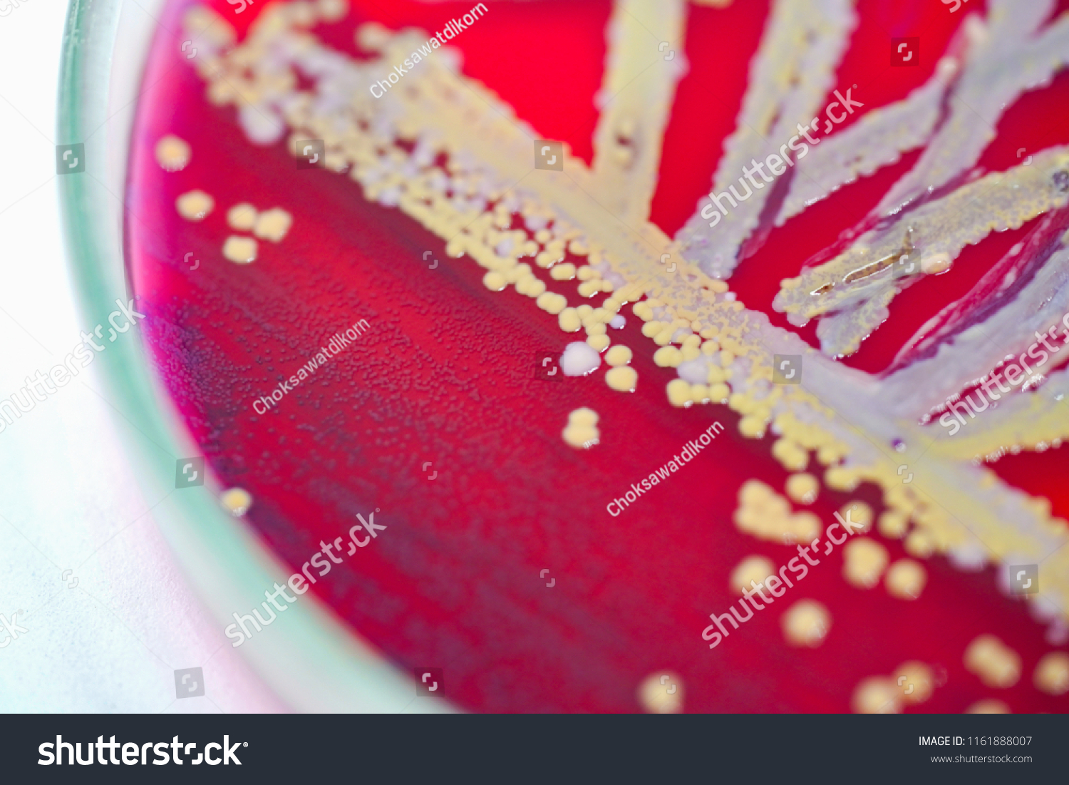 Colony Bacteria Culture Medium Plate Microbiology Stock Photo Shutterstock