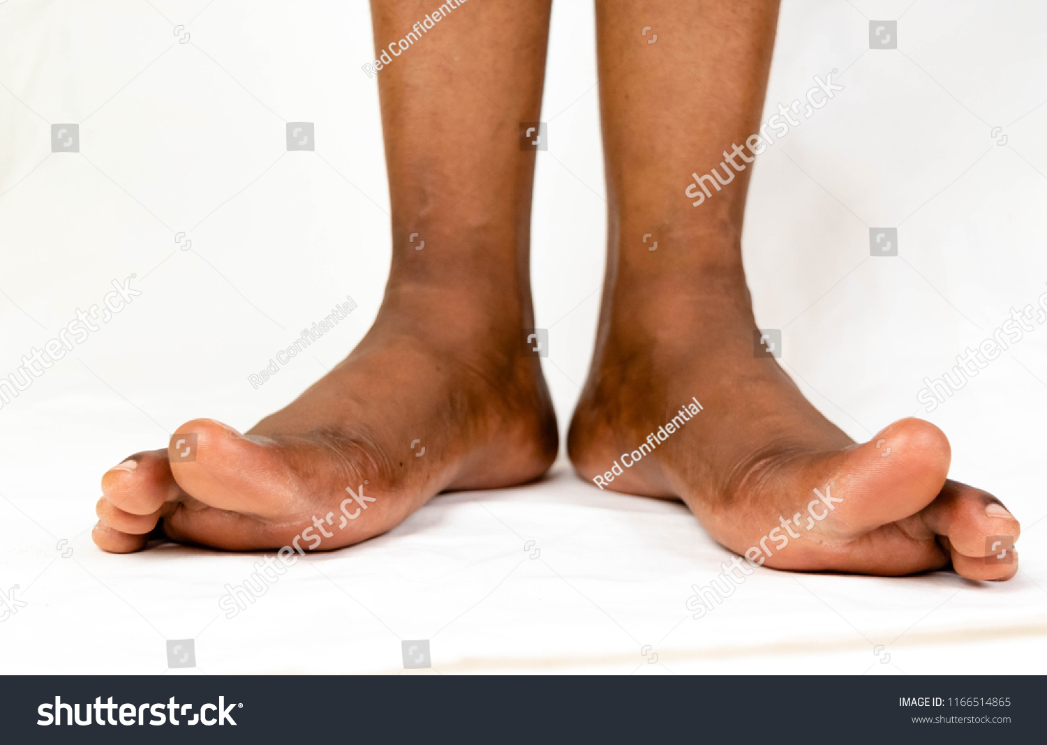 Pretty Black Feet
