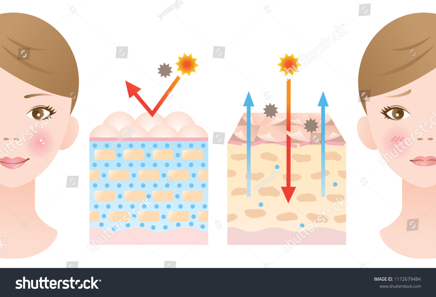 Healthy Dry Skin Diagram Illustration Beauty Stock Vector (Royalty Free ...