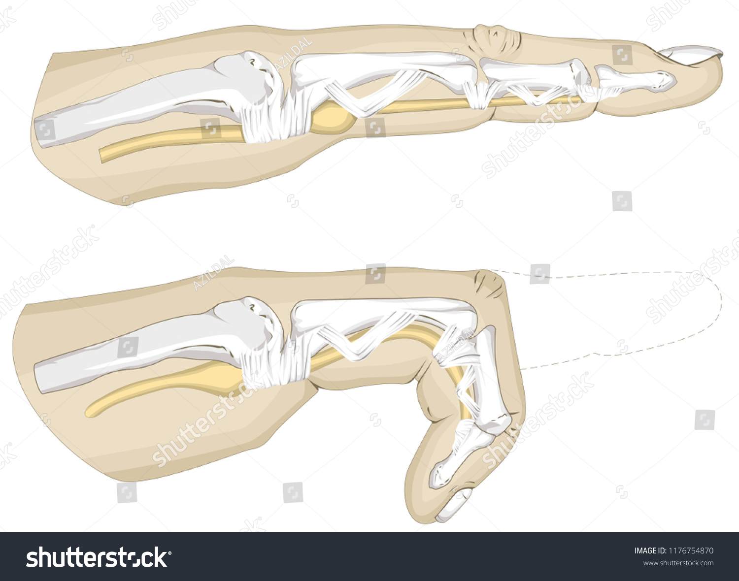 Trigger Finger Illustration Finger Pointing Stock Illustration ...