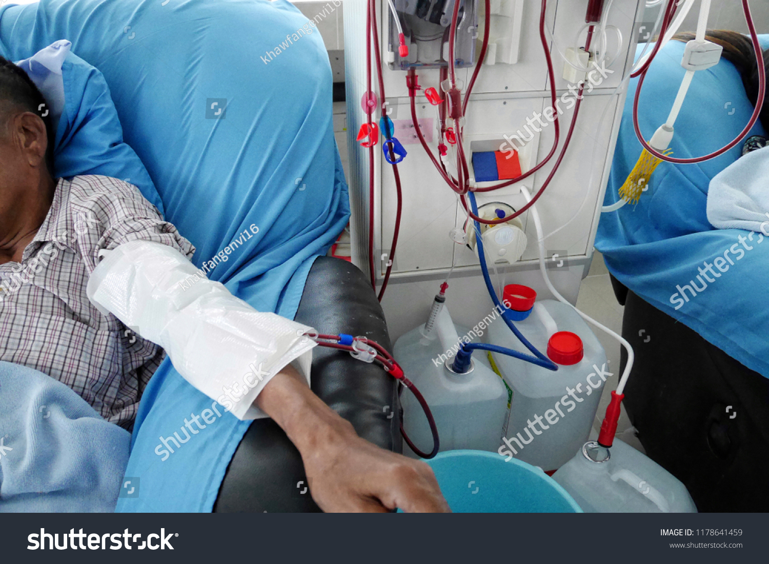 32-blood-pressure-during-dialysis-images-stock-photos-vectors-shutterstock