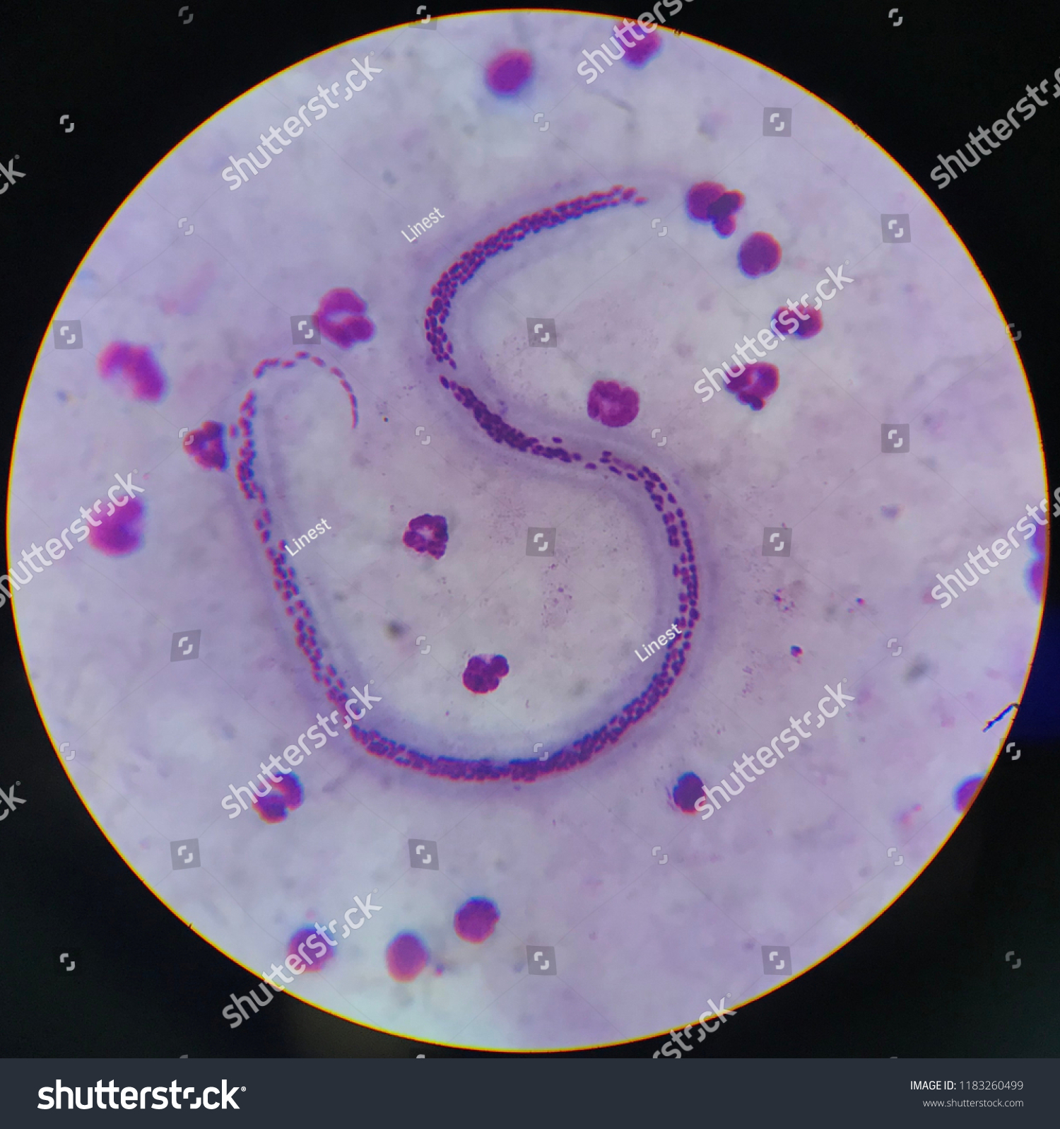 Wuchereria Bancrofti Light Microscope Stock Photo 1183260499 | Shutterstock