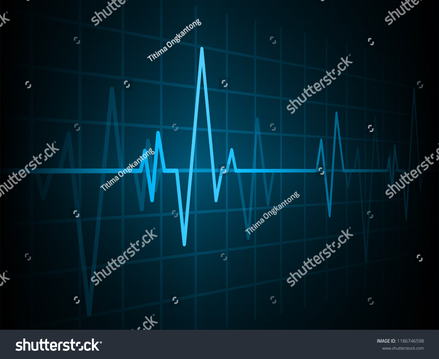 Blue Heart Pulse Monitor Signal Heart Stock Vector Royalty Free 1186746598 Shutterstock 8073