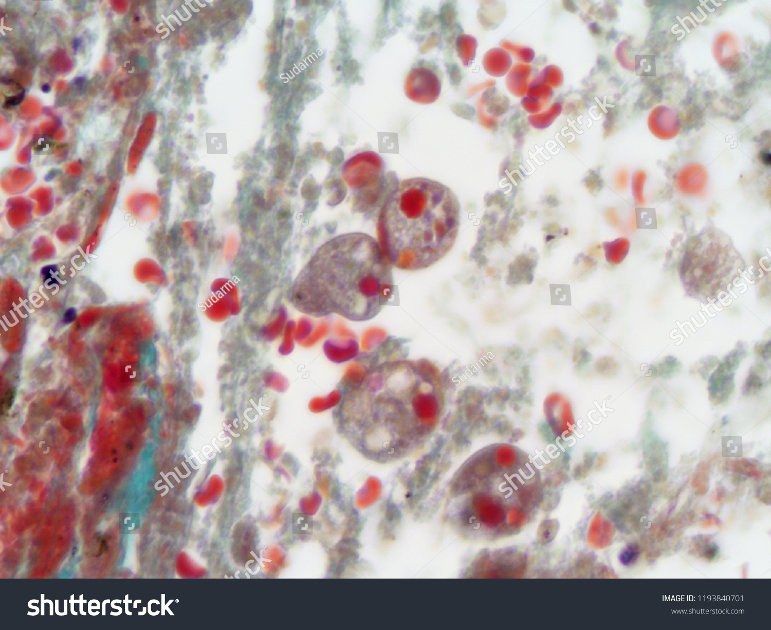 Entamoeba Histolytica 1000x Magnification Goldners Trichrome Foto De Stock 1193840701 Shutterstock 3873