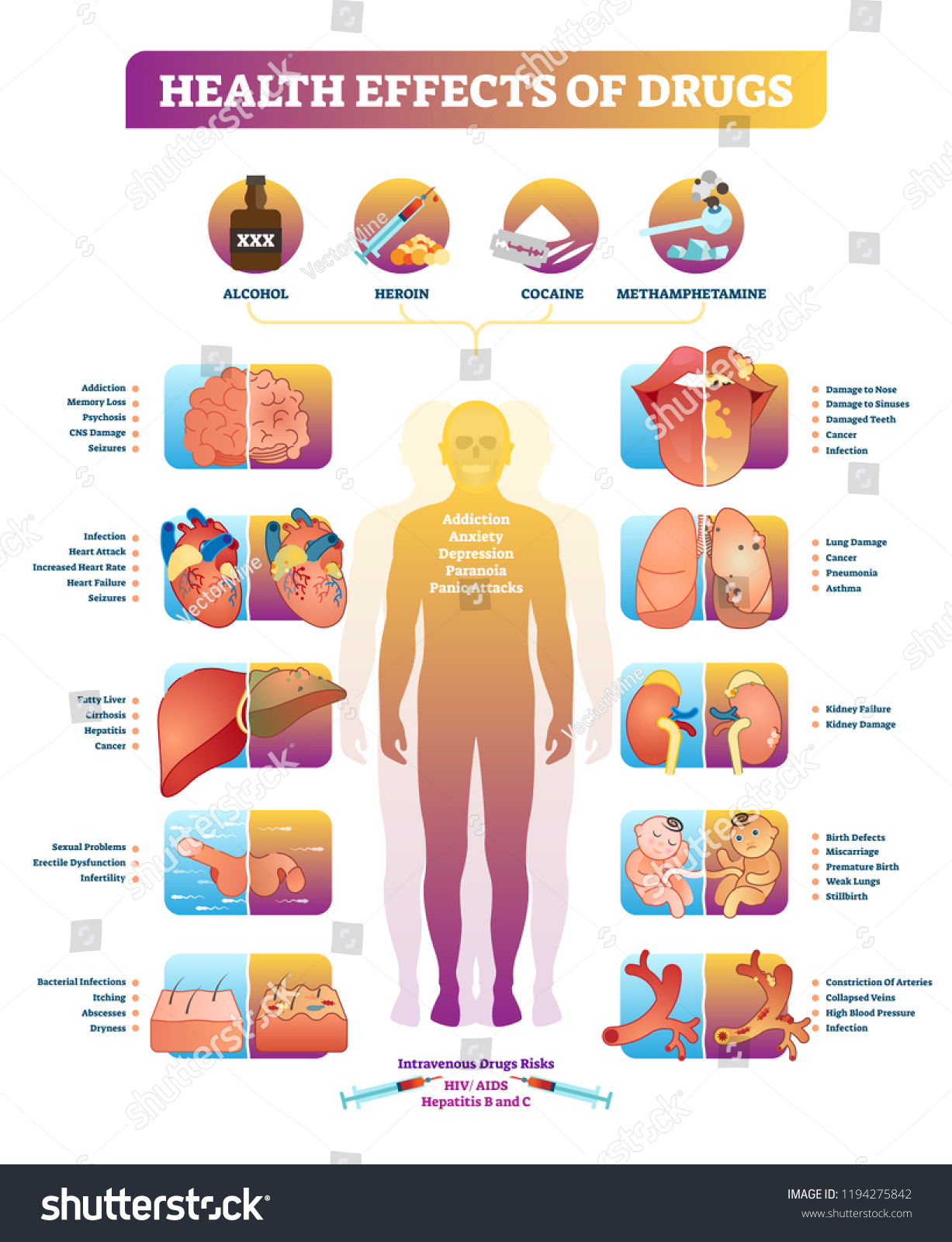 Health Effects Illegal Drugs Vector Illustration Stock Vector (Royalty ...