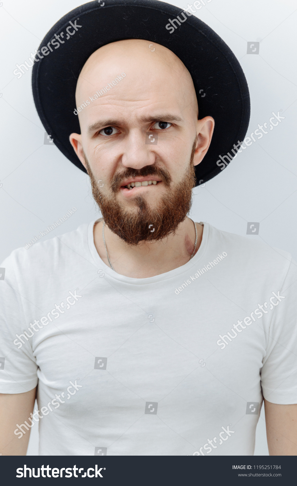 fedora bald head