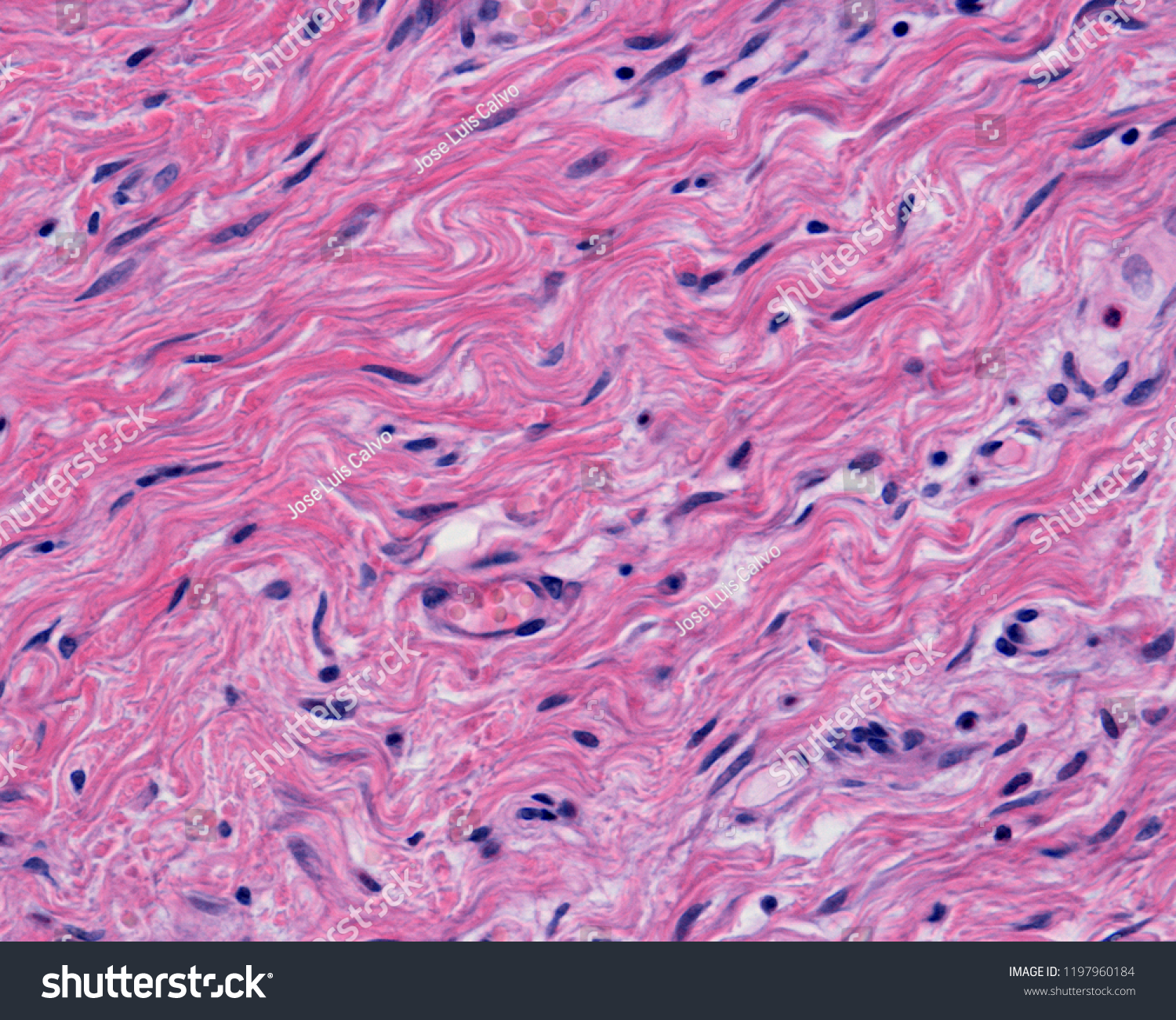 Reticular Dense Irregular Connective Tissue Stock Photo 1197960184 | Shutterstock