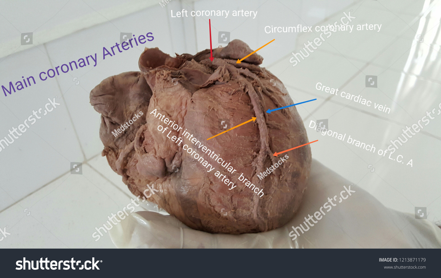 great cardiac vein cadaver