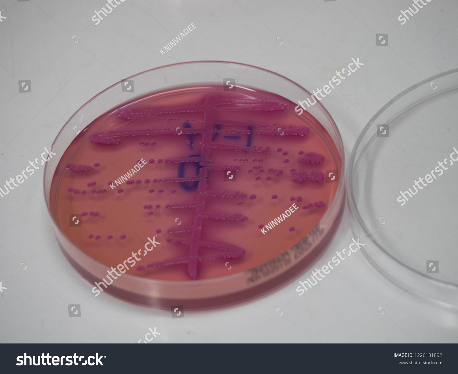 Escherichia Coli Bacteria Culture Growth On Stock Photo 1226181892 ...