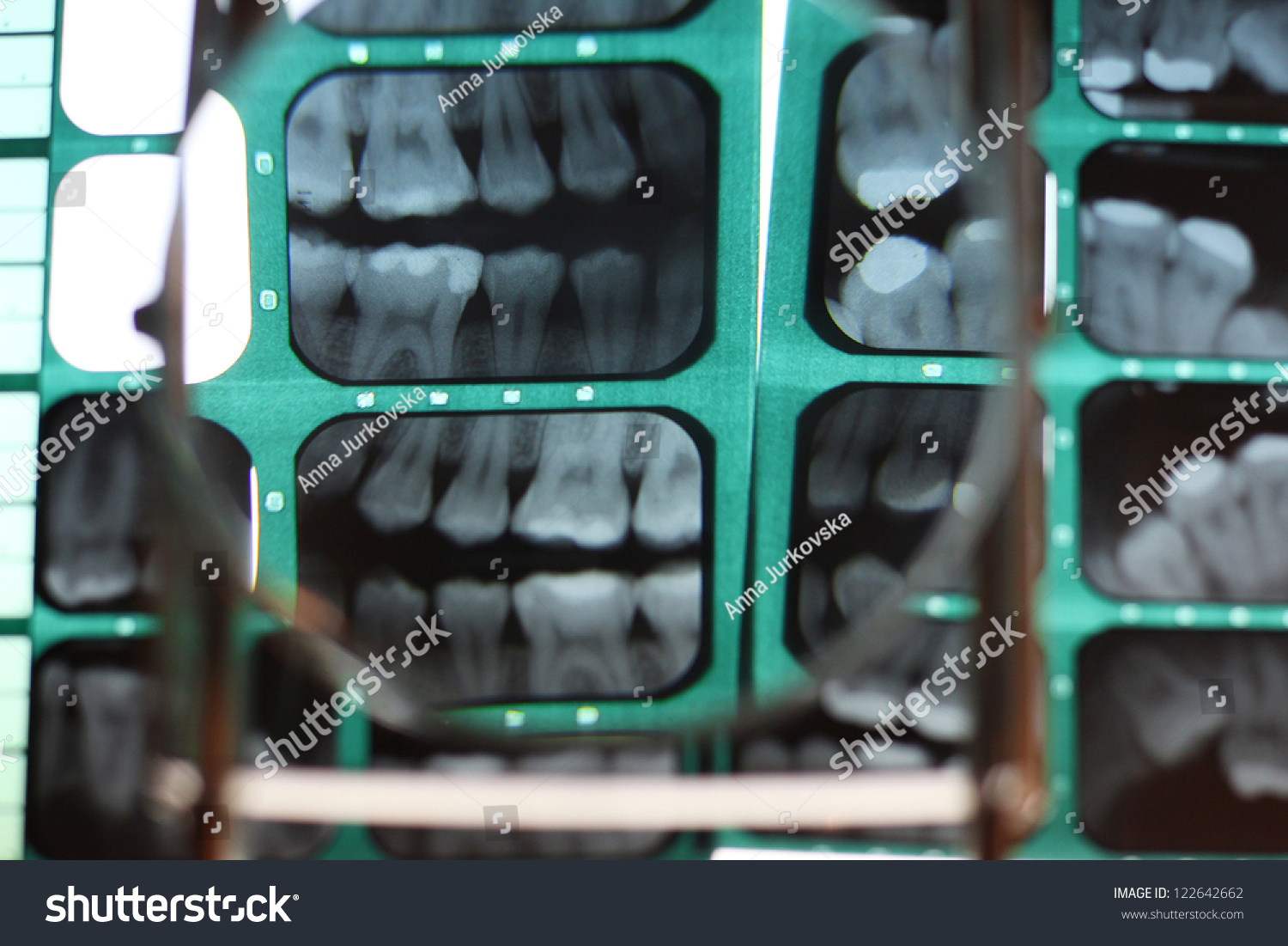 Dental Xray Background Stock Photo 122642662 | Shutterstock