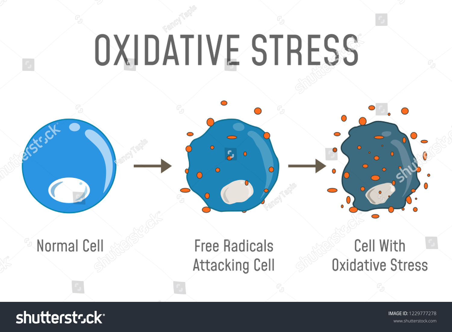 Oxidative Stress Diagram Free Radicals Attacking Stock Illustration ...