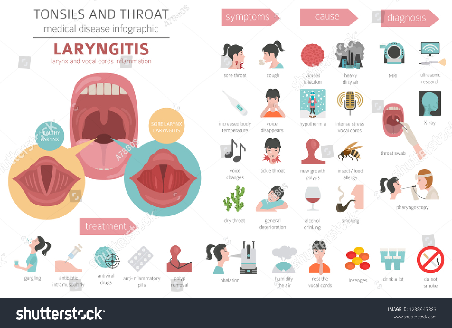 Tonsils Throat Diseases Laryngitis Symptoms Treatment Stock Vector ...