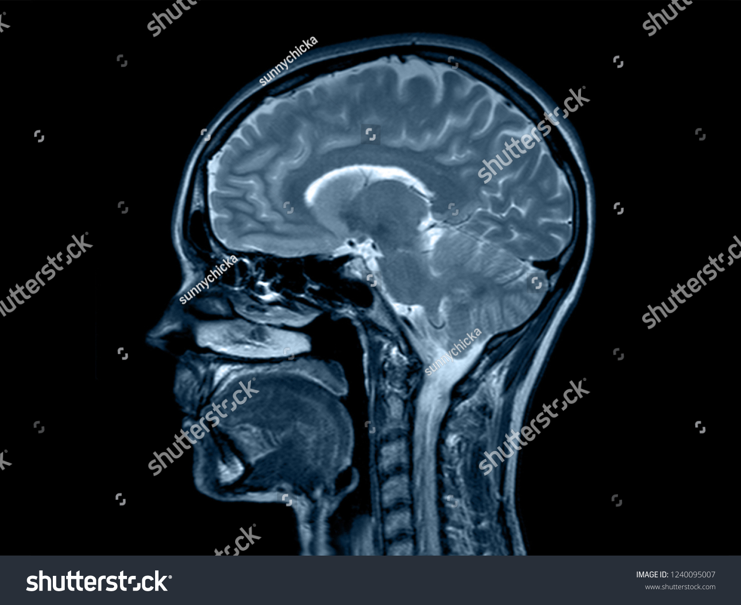 Brain Xray Ct Head Vertebrae Spine Stock Photo 1240095007 | Shutterstock