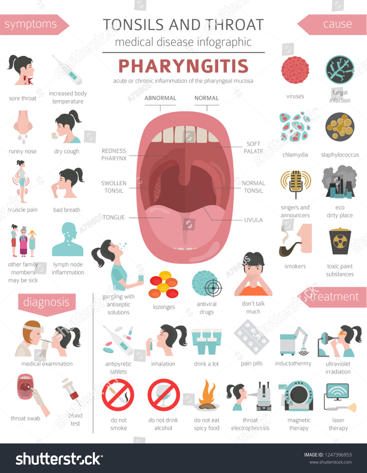 Tonsils Throat Diseases Pharyngitis Symptoms Treatment Stock Vector ...