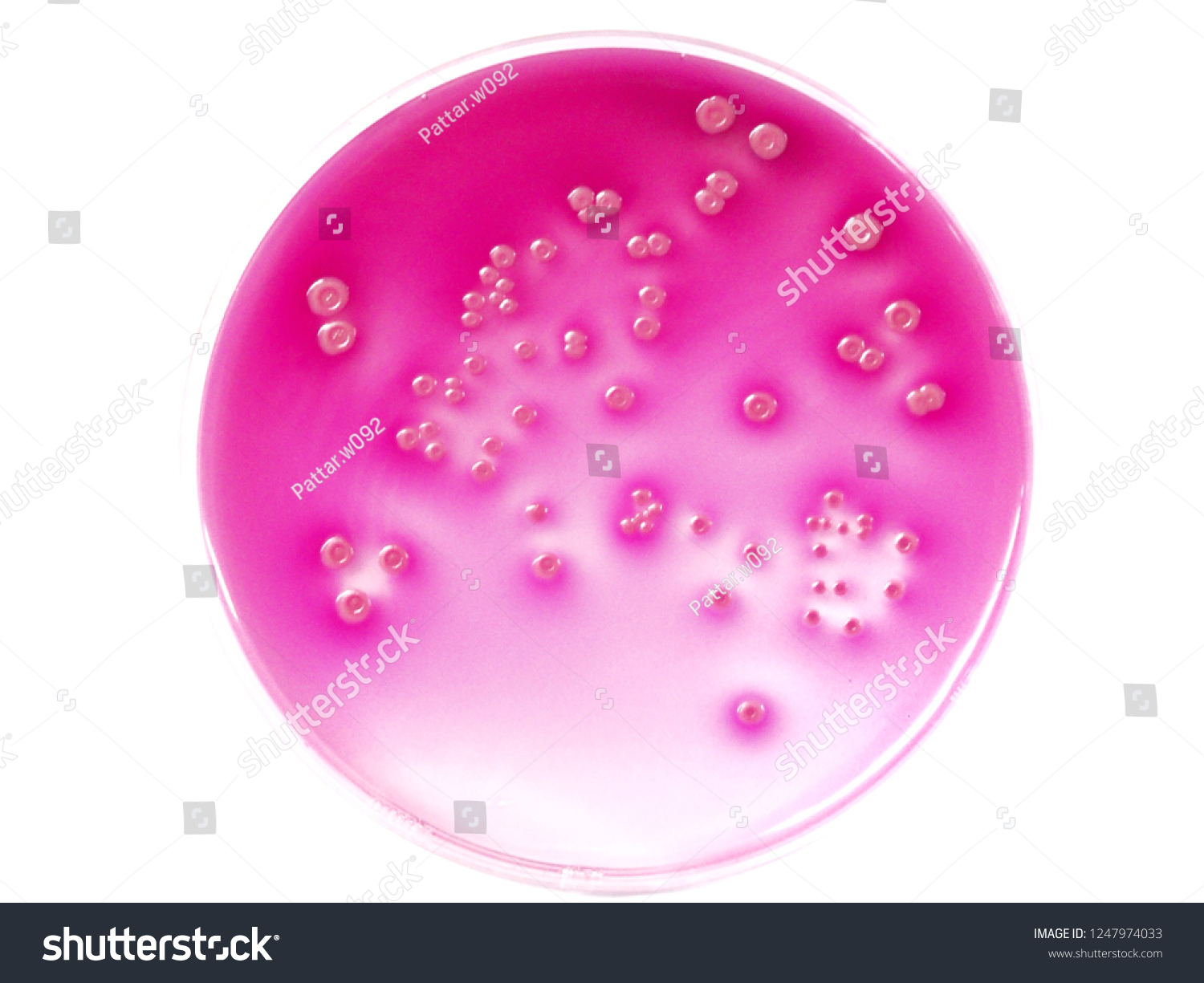 Bacterial Pathogen Escherichia Coli E Coli Stock Photo 1247974033 ...