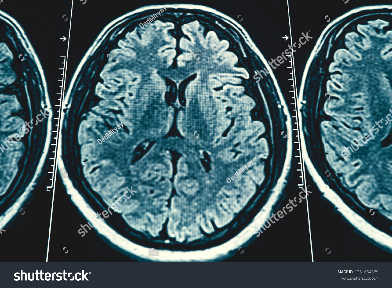 Xray Mri Brain Scan Background Magnetic Stock Illustration 1251664879 ...