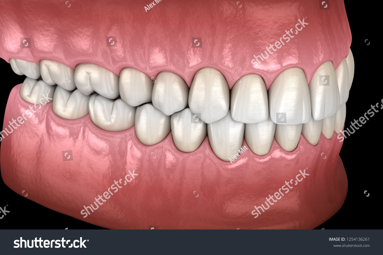 Человеческие зубы сбоку